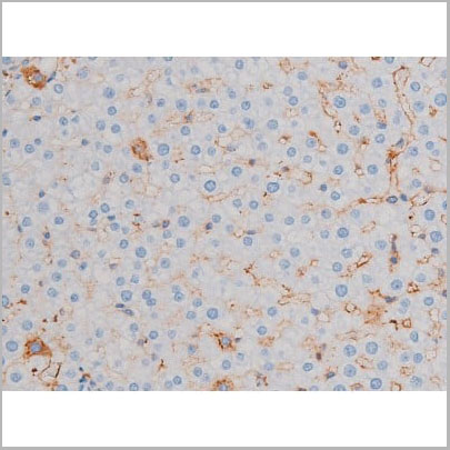 product-image-AAA31034_IHC7.jpg