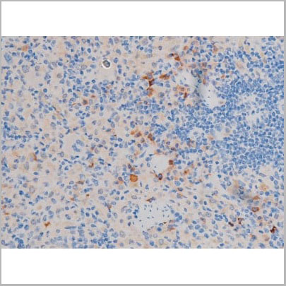 product-image-AAA31034_IHC9.jpg