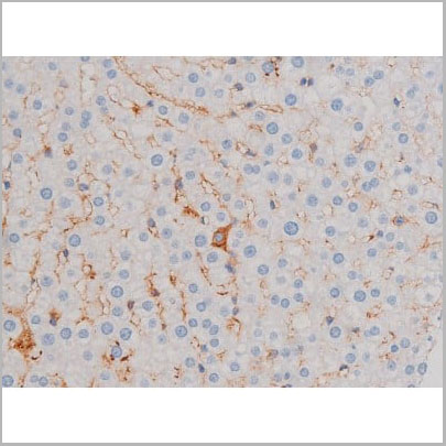 product-image-AAA31035_IHC10.jpg