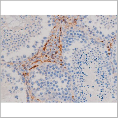 product-image-AAA31035_IHC2.jpg