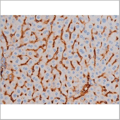 product-image-AAA31035_IHC3.jpg