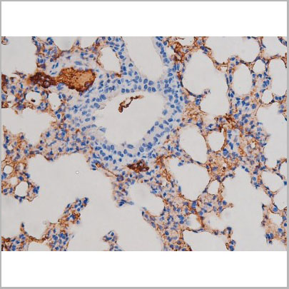 product-image-AAA31035_IHC5.jpg