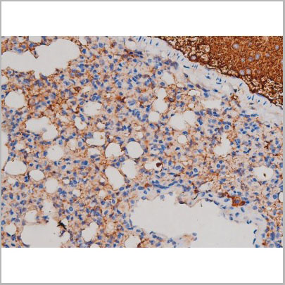 product-image-AAA31035_IHC6.jpg