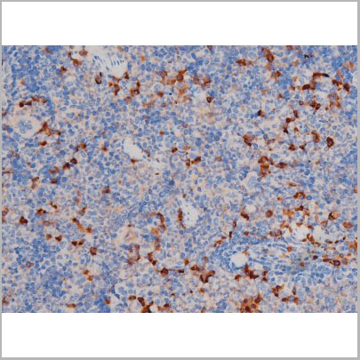 product-image-AAA31035_IHC7.jpg