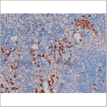 product-image-AAA31035_IHC8.jpg