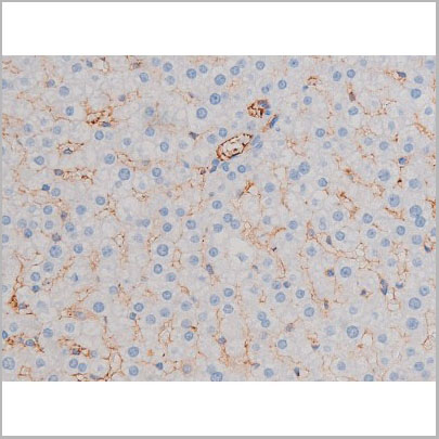 product-image-AAA31035_IHC9.jpg