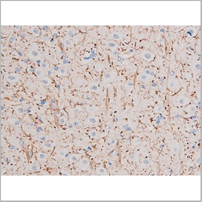 product-image-AAA31036_IHC10.jpg