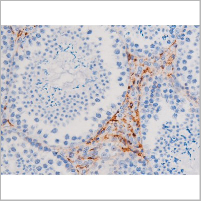 product-image-AAA31036_IHC5.jpg