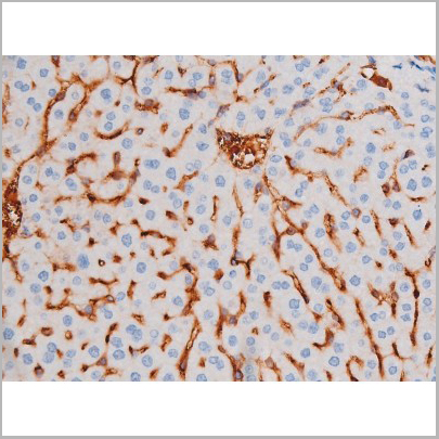 product-image-AAA31036_IHC6.jpg