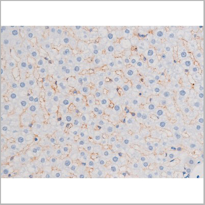 product-image-AAA31036_IHC8.jpg