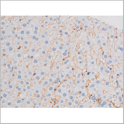 product-image-AAA31036_IHC9.jpg