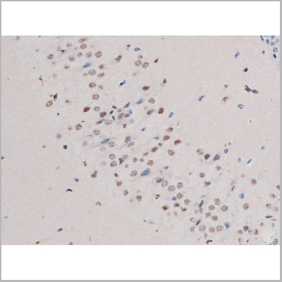 product-image-AAA31037_IHC10.jpg