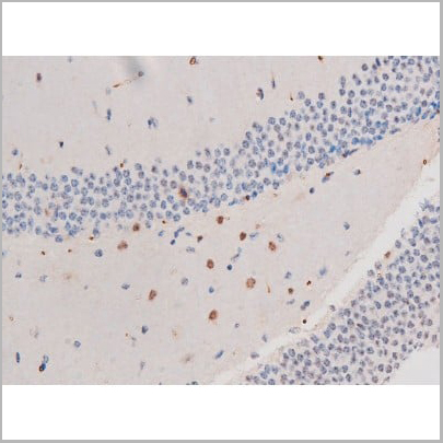 product-image-AAA31037_IHC11.jpg