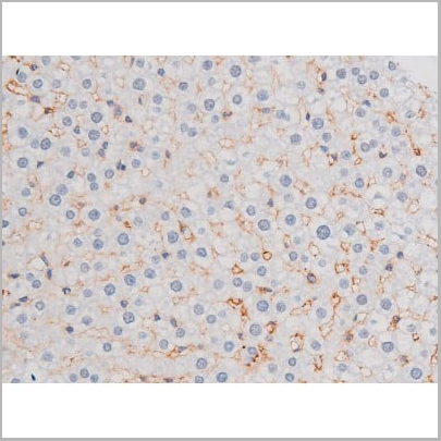 product-image-AAA31037_IHC12.jpg