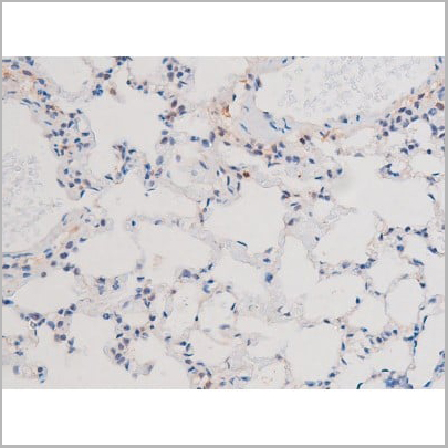 product-image-AAA31037_IHC13.jpg