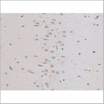 product-image-AAA31037_IHC14.jpg