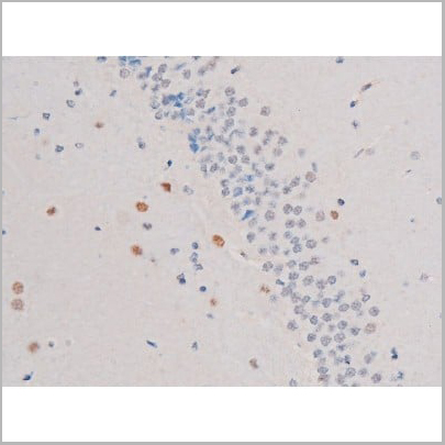 product-image-AAA31037_IHC15.jpg