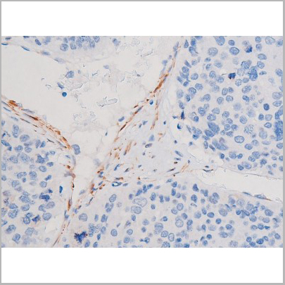 product-image-AAA31037_IHC5.jpg