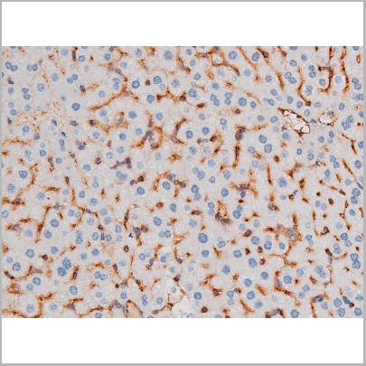 product-image-AAA31037_IHC7.jpg