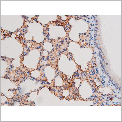 product-image-AAA31037_IHC8.jpg