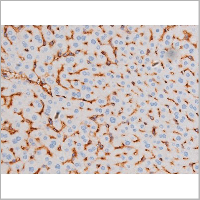 product-image-AAA31038_IHC3.jpg
