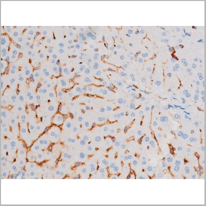 product-image-AAA31038_IHC4.jpg