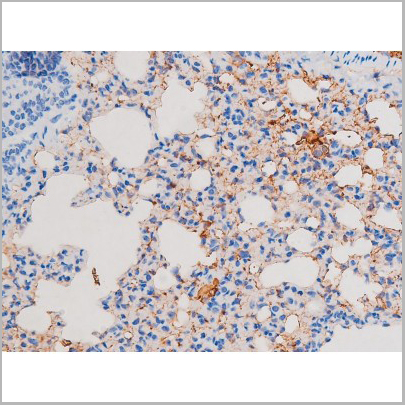 product-image-AAA31038_IHC5.jpg