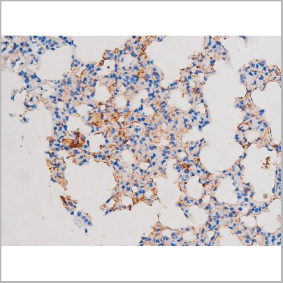 product-image-AAA31038_IHC6.jpg