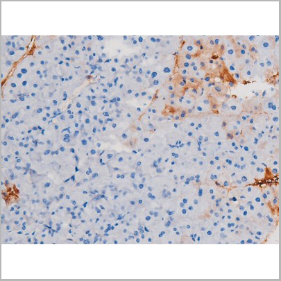 product-image-AAA31038_IHC7.jpg