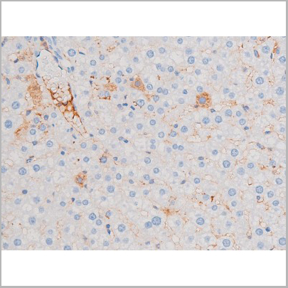 product-image-AAA31038_IHC8.jpg