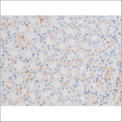 product-image-AAA31038_IHC9.jpg