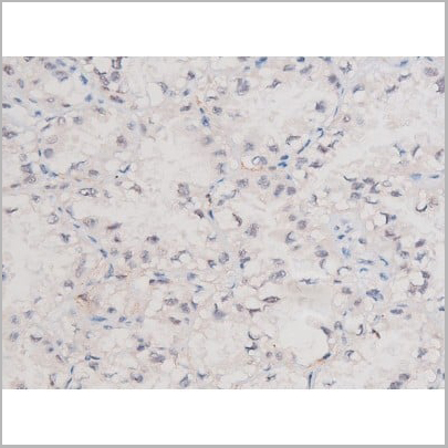 product-image-AAA31039_IHC10.jpg