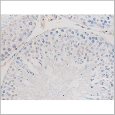 product-image-AAA31039_IHC14.jpg