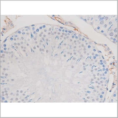 product-image-AAA31039_IHC15.jpg