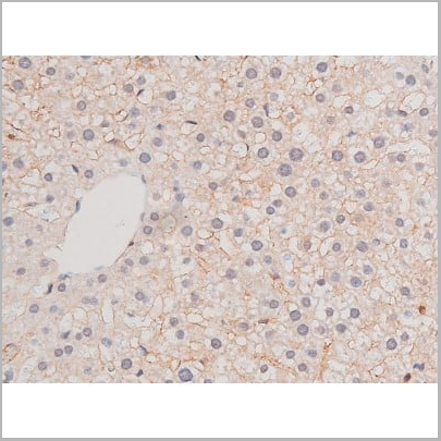 product-image-AAA31039_IHC16.jpg
