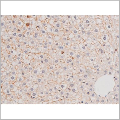 product-image-AAA31039_IHC17.jpg