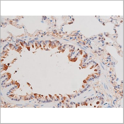product-image-AAA31039_IHC18.jpg