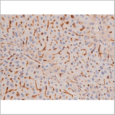 product-image-AAA31039_IHC2.jpg