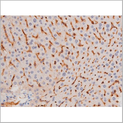 product-image-AAA31039_IHC3.jpg