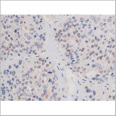 product-image-AAA31039_IHC4.jpg