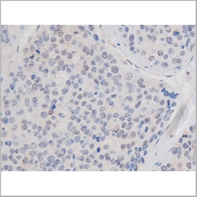 product-image-AAA31039_IHC5.jpg