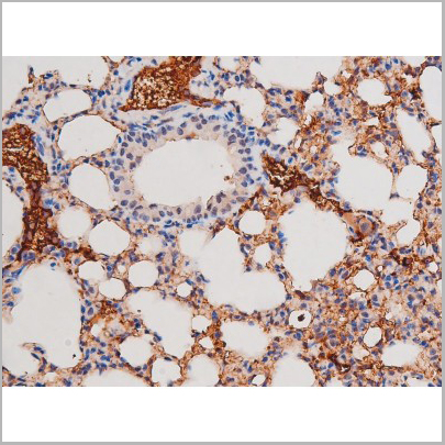 product-image-AAA31039_IHC6.jpg