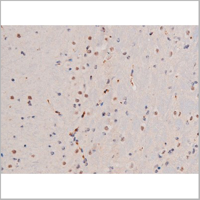 product-image-AAA31039_IHC8.jpg