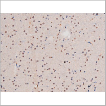 product-image-AAA31039_IHC9.jpg