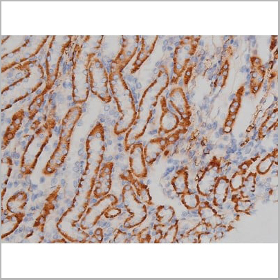 product-image-AAA31040_IHC10.jpg