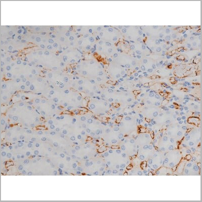 product-image-AAA31040_IHC12.jpg