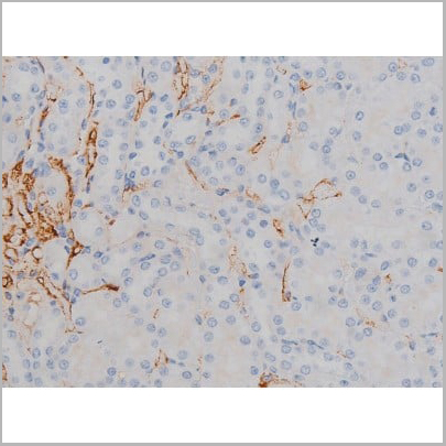 product-image-AAA31040_IHC13.jpg