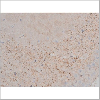 product-image-AAA31040_IHC14.jpg