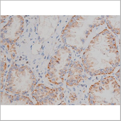 product-image-AAA31040_IHC3.jpg