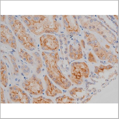 product-image-AAA31040_IHC4.jpg